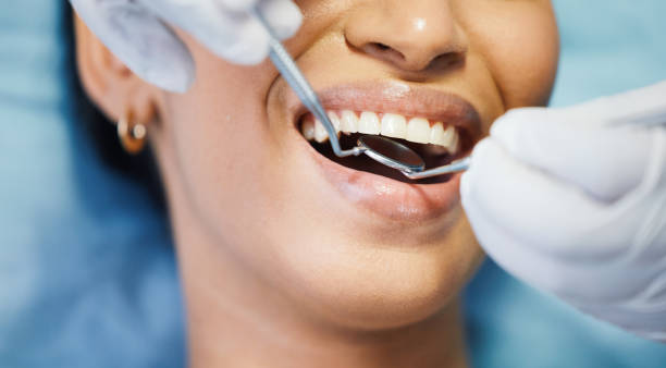 Best Emergency Dental Surgery in Dade City, FL